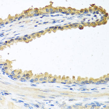 Cochlin / COCH Antibody - Immunohistochemistry of paraffin-embedded human prostate.