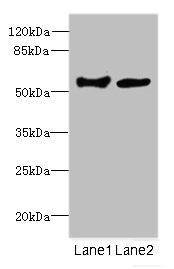 Cochlin / COCH Antibody - Western blot All Lanes: COCH antibody at 1.73ug/ml Lane 1 : Human placenta tissue Lane 2 : 293T whole cell lysate Secondary Goat polyclonal to Rabbit IgG at 1/10000 dilution Predicted band size: 60,54 kDa Observed band size: 59 kDa