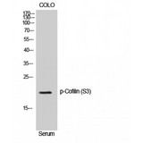 Cofilin Antibody - Western blot of Phospho-Cofilin (S3) antibody