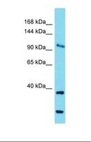 COG1 Antibody - Western blot of Mouse Brain. Cog1 antibody dilution 1.0 ug/ml.  This image was taken for the unconjugated form of this product. Other forms have not been tested.