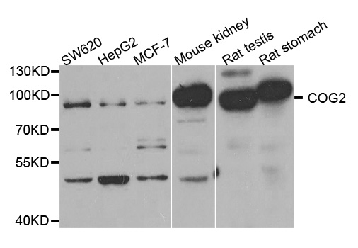 COG2 Antibody - Western blot analysis of extracts of various cell lines.