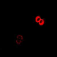 COG2 Antibody - Immunofluorescent analysis of COG2 staining in MCF7 cells. Formalin-fixed cells were permeabilized with 0.1% Triton X-100 in TBS for 5-10 minutes and blocked with 3% BSA-PBS for 30 minutes at room temperature. Cells were probed with the primary antibody in 3% BSA-PBS and incubated overnight at 4 deg C in a humidified chamber. Cells were washed with PBST and incubated with a DyLight 594-conjugated secondary antibody (red) in PBS at room temperature in the dark.