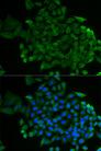 COG2 Antibody - Immunofluorescence analysis of MCF-7 cells using COG2 Polyclonal Antibody.