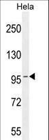 COG3 Antibody - COG3 Antibody western blot of HeLa cell line lysates (35 ug/lane). The COG3 antibody detected the COG3 protein (arrow).