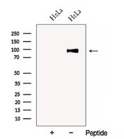 COG3 Antibody - Western blot analysis of extracts of HeLa cells using COG3 antibody. The lane on the left was treated with blocking peptide.