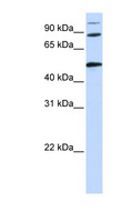 COG4 Antibody - COG4 antibody Western blot of HeLa lysate. This image was taken for the unconjugated form of this product. Other forms have not been tested.
