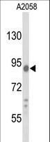 COG4 Antibody - Western blot of COG4 Antibody in A2058 cell line lysates (35 ug/lane). COG4 (arrow) was detected using the purified antibody.