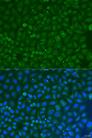 COG4 Antibody - Immunofluorescence analysis of U2OS cells using COG4 Polyclonal Antibody at dilution of 1:100.Blue: DAPI for nuclear staining.