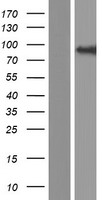 COG4 Protein - Western validation with an anti-DDK antibody * L: Control HEK293 lysate R: Over-expression lysate