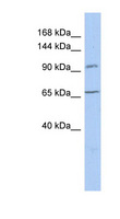 COG5 Antibody - COG5 antibody Western blot of THP-1 cell lysate. This image was taken for the unconjugated form of this product. Other forms have not been tested.