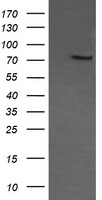 COG6 Antibody - HEK293T cells were transfected with the pCMV6-ENTRY control (Left lane) or pCMV6-ENTRY COG6 (Right lane) cDNA for 48 hrs and lysed. Equivalent amounts of cell lysates (5 ug per lane) were separated by SDS-PAGE and immunoblotted with anti-COG6.