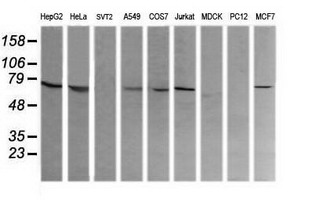 COG6 Antibody - Western blot of extracts (35ug) from 9 different cell lines by using anti-COG6 monoclonal antibody (HepG2: human; HeLa: human; SVT2: mouse; A549: human; COS7: monkey; Jurkat: human; MDCK: canine; PC12: rat; MCF7: human).