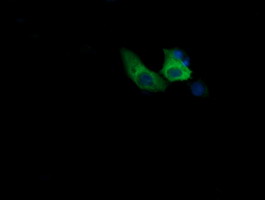 COG6 Antibody - Anti-COG6 mouse monoclonal antibody immunofluorescent staining of COS7 cells transiently transfected by pCMV6-ENTRY COG6.