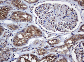 COG6 Antibody - IHC of paraffin-embedded Human Kidney tissue using anti-COG6 mouse monoclonal antibody. (Heat-induced epitope retrieval by 10mM citric buffer, pH6.0, 120°C for 3min).