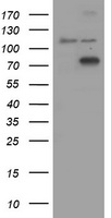 COG6 Antibody - HEK293T cells were transfected with the pCMV6-ENTRY control (Left lane) or pCMV6-ENTRY COG6 (Right lane) cDNA for 48 hrs and lysed. Equivalent amounts of cell lysates (5 ug per lane) were separated by SDS-PAGE and immunoblotted with anti-COG6.