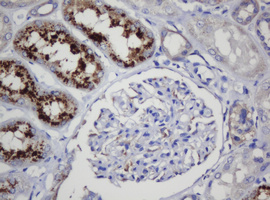 COG6 Antibody - IHC of paraffin-embedded Human Kidney tissue using anti-COG6 mouse monoclonal antibody. (Heat-induced epitope retrieval by 10mM citric buffer, pH6.0, 120°C for 3min).