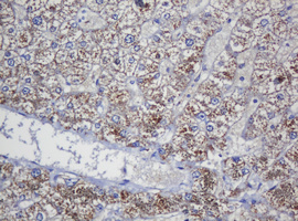 COG6 Antibody - IHC of paraffin-embedded Human liver tissue using anti-COG6 mouse monoclonal antibody. (Heat-induced epitope retrieval by 10mM citric buffer, pH6.0, 120°C for 3min).