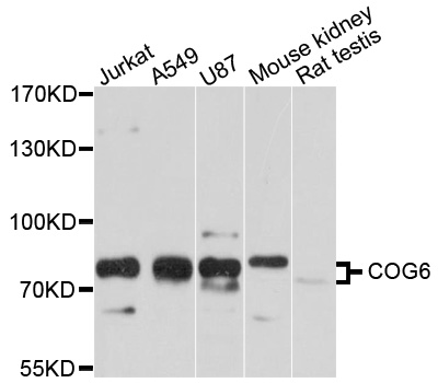 COG6 Antibody - Western blot analysis of extracts of various cell lines, using COG6 antibody at 1:1000 dilution. The secondary antibody used was an HRP Goat Anti-Rabbit IgG (H+L) at 1:10000 dilution. Lysates were loaded 25ug per lane and 3% nonfat dry milk in TBST was used for blocking. An ECL Kit was used for detection and the exposure time was 10s.