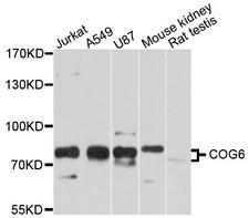 COG6 Antibody - Western blot analysis of extracts of various cell lines, using COG6 antibody at 1:1000 dilution. The secondary antibody used was an HRP Goat Anti-Rabbit IgG (H+L) at 1:10000 dilution. Lysates were loaded 25ug per lane and 3% nonfat dry milk in TBST was used for blocking. An ECL Kit was used for detection and the exposure time was 10s.