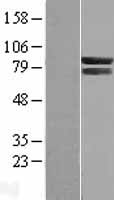 COG7 Protein - Western validation with an anti-DDK antibody * L: Control HEK293 lysate R: Over-expression lysate