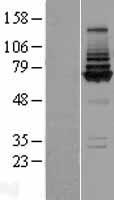 COG8 Protein - Western validation with an anti-DDK antibody * L: Control HEK293 lysate R: Over-expression lysate