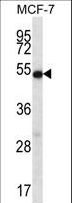 COIL / Coilin Antibody - COIL Antibody western blot of MCF-7 cell line lysates (35 ug/lane). The COIL antibody detected the COIL protein (arrow).