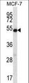 COIL / Coilin Antibody - COIL Antibody western blot of MCF-7 cell line lysates (35 ug/lane). The COIL antibody detected the COIL protein (arrow).