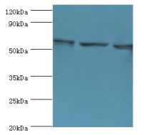 COIL / Coilin Antibody - Western blot. All lanes: COIL antibody at 3 ug/ml. Lane 1: MCF-7 whole cell lysate. Lane 2: HeLa whole cell lysate. Lane 3: HepG2 whole cell lysate. Secondary antibody: Goat polyclonal to rabbit at 1:10000 dilution. Predicted band size: 63 kDa. Observed band size: 63 kDa.