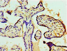 COIL / Coilin Antibody - Immunohistochemistry of paraffin-embedded human placenta tissue using antibody at 1:100 dilution.