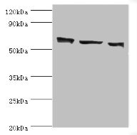 COIL / Coilin Antibody - Western blot All lanes: COIL antibody at 3µg/ml Lane 1: MCF-7 whole cell lysate Lane 2: Hela whole cell lysate Lane 3: HepG2 whole cell lysate Secondary Goat polyclonal to rabbit IgG at 1/10000 dilution Predicted band size: 63 kDa Observed band size: 63 kDa