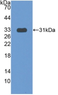 COIL / Coilin Antibody