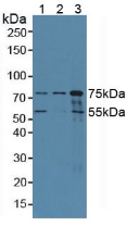 COIL / Coilin Antibody