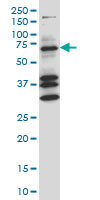 COIL / Coilin Antibody - COIL monoclonal antibody (M05A), clone 4B8 Western Blot analysis of COIL expression in NIH/3T3.