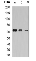 COIL / Coilin Antibody - Western blot analysis of Coilin expression in MCF7 (A); HepG2 (B); rat testis (C) whole cell lysates.