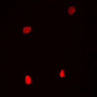 COIL / Coilin Antibody - Immunofluorescent analysis of Coilin staining in HeLa cells. Formalin-fixed cells were permeabilized with 0.1% Triton X-100 in TBS for 5-10 minutes and blocked with 3% BSA-PBS for 30 minutes at room temperature. Cells were probed with the primary antibody in 3% BSA-PBS and incubated overnight at 4 deg C in a humidified chamber. Cells were washed with PBST and incubated with a DyLight 594-conjugated secondary antibody (red) in PBS at room temperature in the dark.