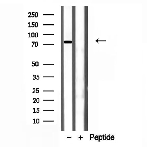 COIL / Coilin Antibody - Western blot analysis of extracts of K562 cells using Coilin antibody.