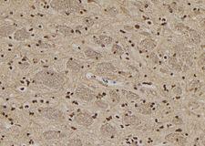 COIL / Coilin Antibody - 1:100 staining rat brain tissue by IHC-P. The sample was formaldehyde fixed and a heat mediated antigen retrieval step in citrate buffer was performed. The sample was then blocked and incubated with the antibody for 1.5 hours at 22°C. An HRP conjugated goat anti-rabbit antibody was used as the secondary.