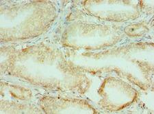 COL10A1 / Collagen X Antibody - Immunohistochemistry of paraffin-embedded human prostate using antibody at 1:100 dilution.
