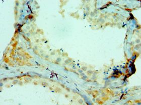 COL10A1 / Collagen X Antibody - Immunohistochemistry of paraffin-embedded human testicle using antibody at 1:100 dilution.