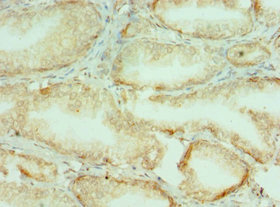COL10A1 / Collagen X Antibody - Immunohistochemistry of paraffin-embedded human prostate tissue using COL10A1 Antibody at dilution of 1:100