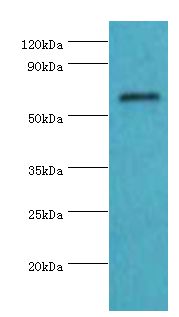 COL10A1 / Collagen X Antibody - Western blot. All lanes: Collagen alpha-1(X) chain antibody at 4 ug/ml+K562 whole cell lysate. Secondary antibody: Goat polyclonal to rabbit at 1:10000 dilution. Predicted band size: 66 kDa. Observed band size: 66 kDa Immunohistochemistry.