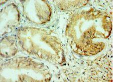 COL10A1 / Collagen X Antibody - Immunohistochemistry of paraffin-embedded human prostate using antibody at 1:100 dilution.