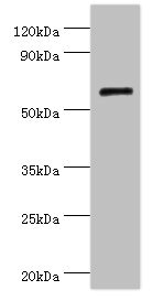 COL10A1 / Collagen X Antibody - Western blot All lanes: COL10A1 antibody at 4µg/ml + K562 whole cell lysate Secondary Goat polyclonal to rabbit IgG at 1/10000 dilution Predicted band size: 66 kDa Observed band size: 66 kDa