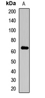 COL10A1 / Collagen X Antibody - Western blot analysis of Collagen 10 alpha 1 expression in MCF7 (A) whole cell lysates
