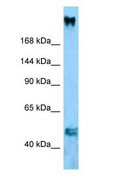 COL11A1 / Collagen XI Alpha 1 Antibody - COL11A1 / Collagen XI antibody Western Blot of Mouse Pancreas.  This image was taken for the unconjugated form of this product. Other forms have not been tested.