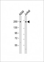 COL11A1 / Collagen XI Alpha 1 Antibody - All lanes: Anti-COL11A1 Antibody (N-Term) at 1:2000 dilution. Lane 1: A549 whole cell lysate. Lane 2: Jurkat whole cell lysate Lysates/proteins at 20 ug per lane. Secondary Goat Anti-Rabbit IgG, (H+L), Peroxidase conjugated at 1:10000 dilution. Predicted band size: 181 kDa. Blocking/Dilution buffer: 5% NFDM/TBST.