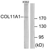 COL11A1 / Collagen XI Alpha 1 Antibody - Western blot analysis of lysates from K562 cells, using Collagen XI alpha1 Antibody. The lane on the right is blocked with the synthesized peptide.