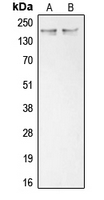 COL11A1 / Collagen XI Alpha 1 Antibody - Western blot analysis of Collagen 11 alpha 1 expression in K562 (A); Saos2 (B) whole cell lysates.