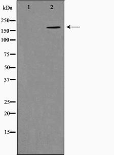 COL11A1 / Collagen XI Alpha 1 Antibody - Western blot analysis on K562 cell lysates using Collagen XIalpha 1 antibody. The lane on the left is treated with the antigen-specific peptide.