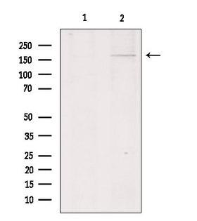 COL11A1 / Collagen XI Alpha 1 Antibody - Western blot analysis of extracts of HepG2 cells using Collagen XIalpha 1 antibody. Lane 1 was treated with the blocking peptide.